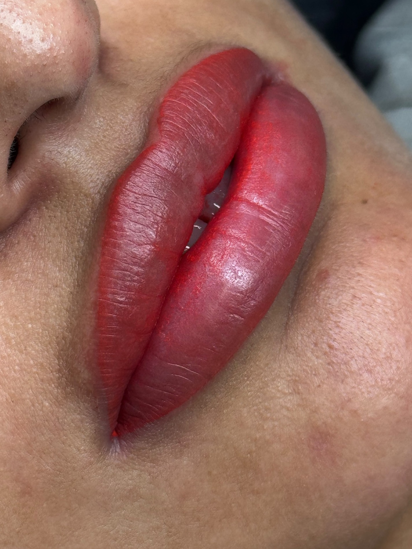 Pigmentación de Labios